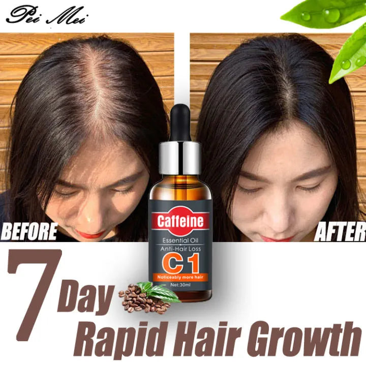 Aceite esencial Anti Caída del pelo