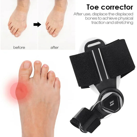 Corrector de Juanetes ajustable para hombres y mujeres.  Alivio universal de la bursitis del pulgar. Corrector del dedo del pie.